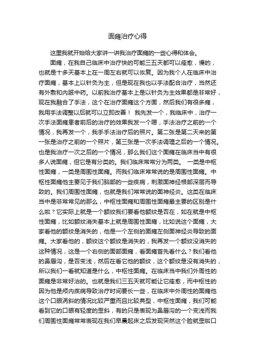 面瘫治疗心得