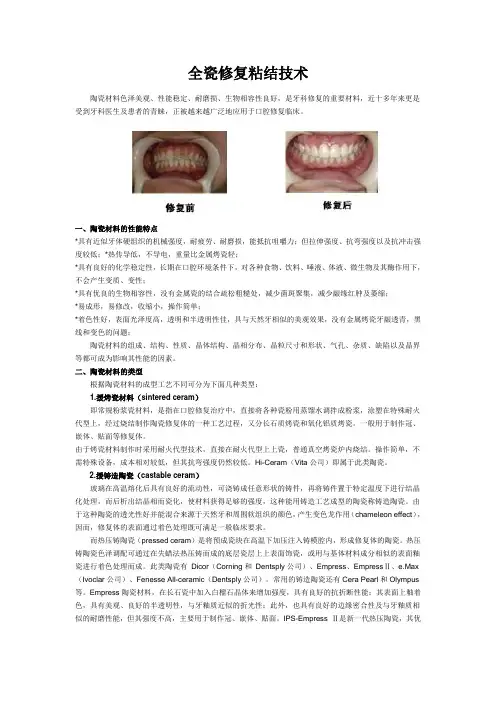 全瓷修复粘结技术