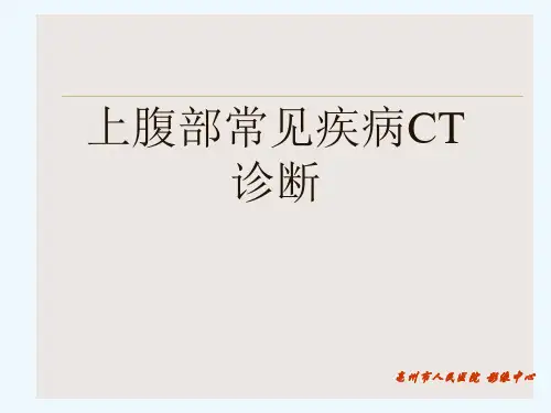 上腹部常见疾病CT诊断[可修改版ppt]