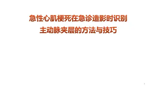 主动脉夹层累及冠脉的识别