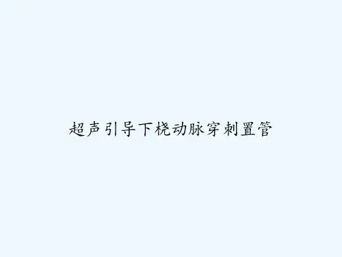 超声引导下桡动脉穿刺置管 PPT
