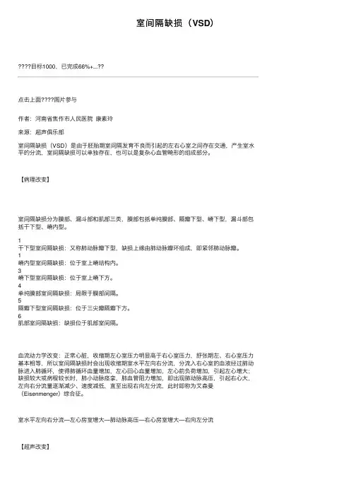 室间隔缺损（VSD）