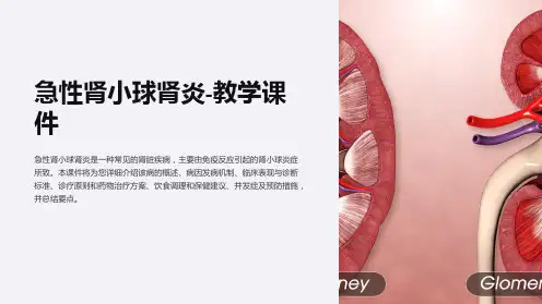 急性肾小球肾炎-教学课件