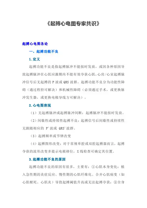《起搏心电图专家共识》