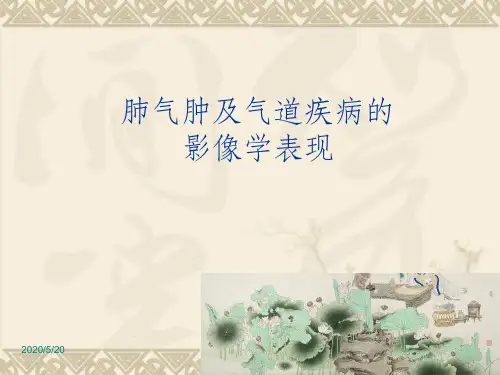 肺气肿及气道疾病的影像学表现