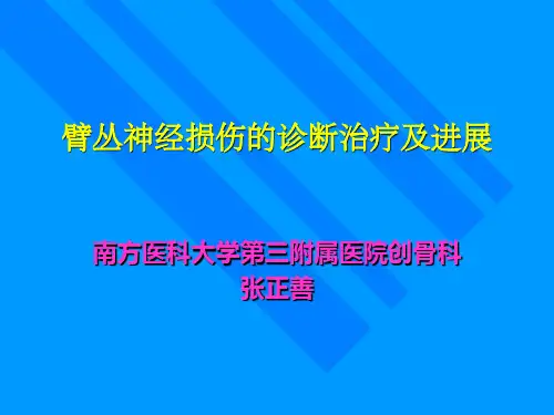臂丛神经