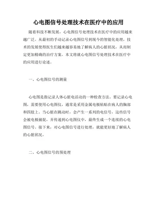 心电图信号处理技术在医疗中的应用