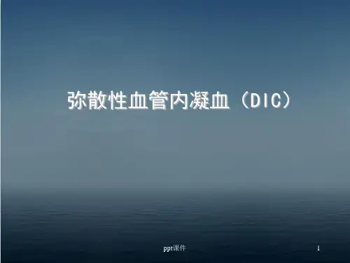 弥散性血管内凝血(DIC)  ppt课件