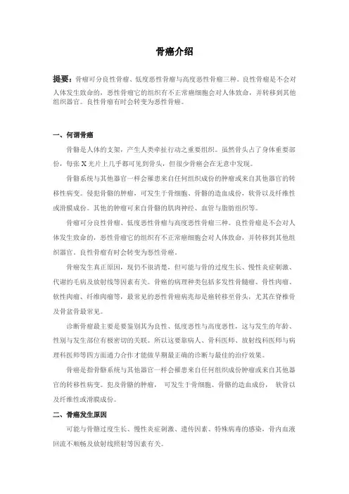 骨癌介绍