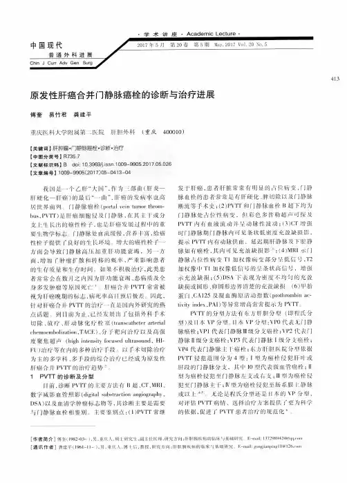 原发性肝癌合并门静脉癌栓的诊断与治疗进展