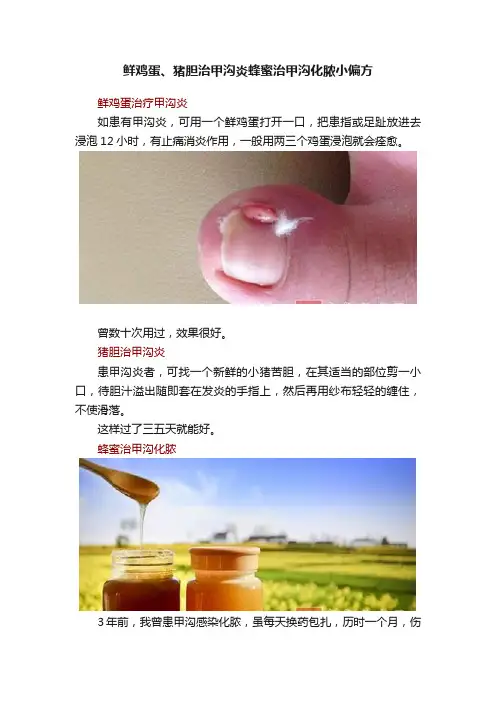 鲜鸡蛋、猪胆治甲沟炎蜂蜜治甲沟化脓小偏方