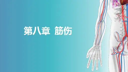 筋伤概论-中医骨伤科学(十三五教材)