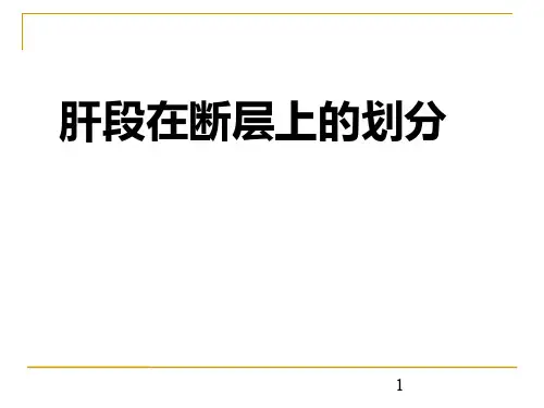 肝段断层解剖PPT课件