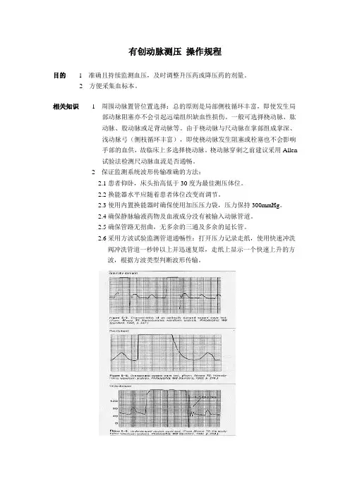 有创动脉测压 操作规程
