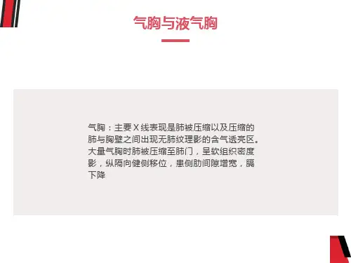 呼吸系统常见疾病影像学表现