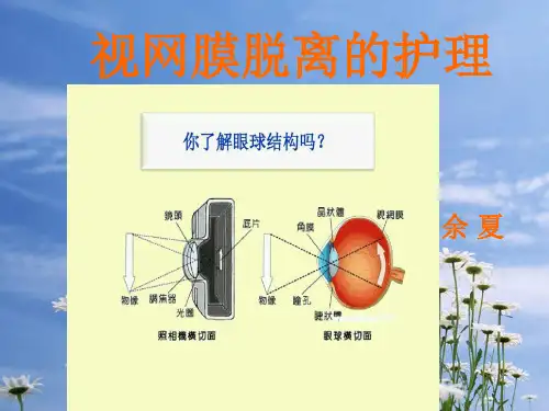 视网膜脱落小讲课PPT课件