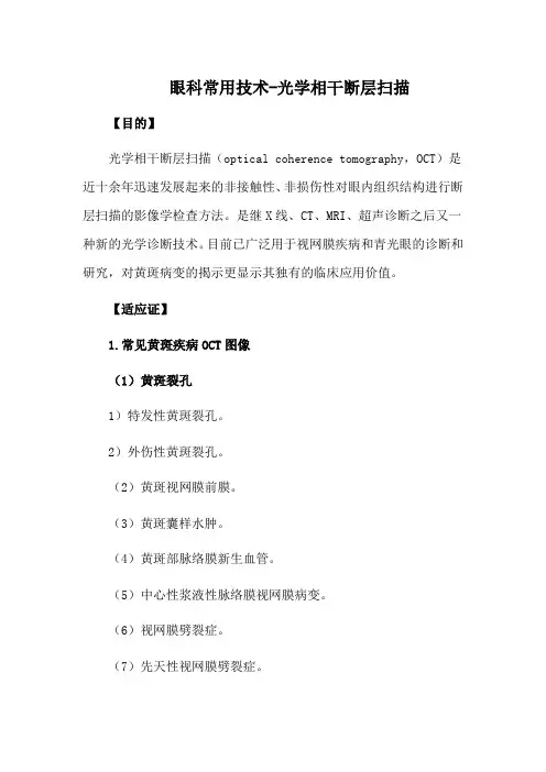 眼科常用技术-光学相干断层扫描