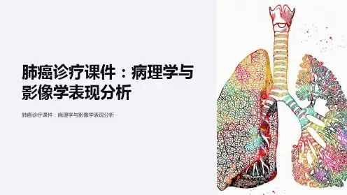 肺癌诊疗课件：病理学与影像学表现分析