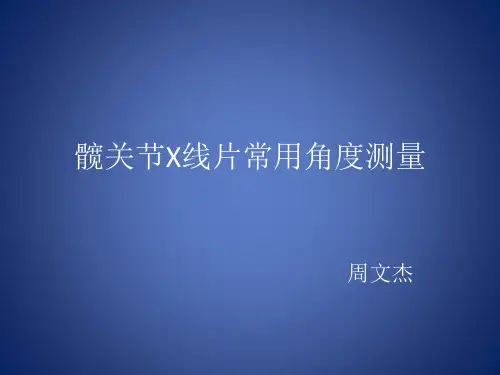 髋关节X光片角度测量