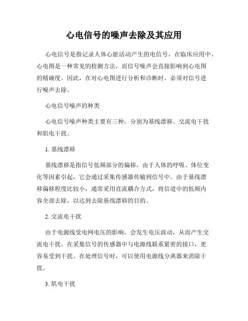 心电信号的噪声去除及其应用