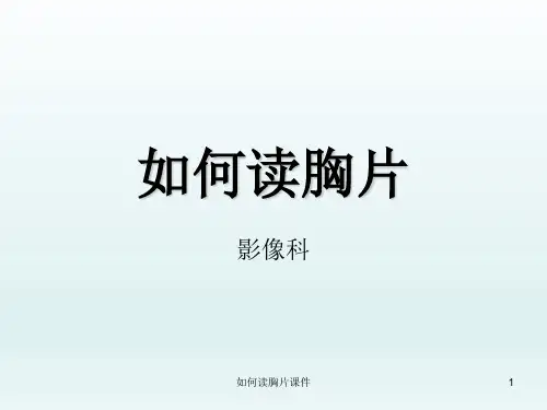 如何读胸片课件