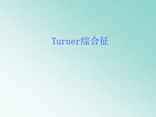 Turner综合征ppt课件精选全文