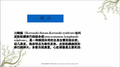 皮肤粘膜淋巴结综合症mucocutaneouslymphnodesyndrom