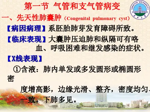 血行播散型肺结核