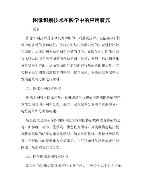 图像识别技术在医学中的应用研究