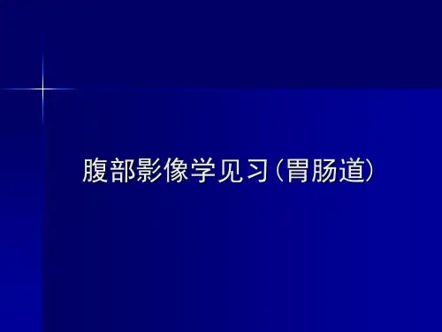 医学影像学：腹部影像学见习(胃肠道)