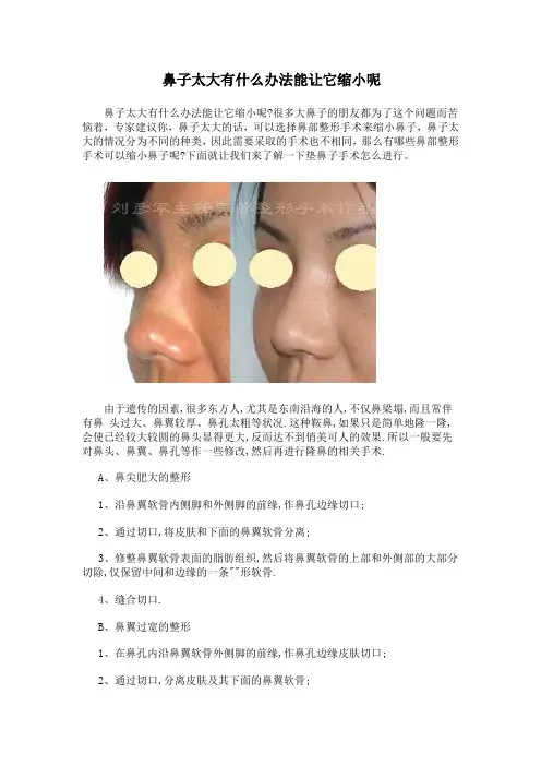 鼻子太大有什么办法能让它缩小呢