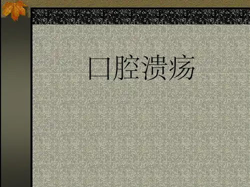 口腔溃疡ppt课件