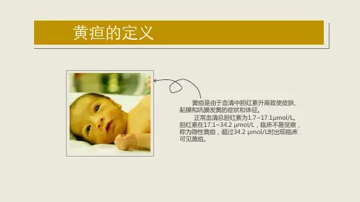常见症状黄疸