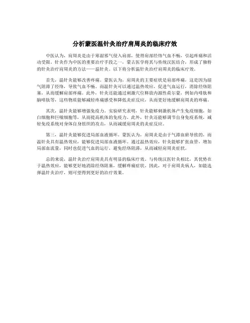分析蒙医温针灸治疗肩周炎的临床疗效