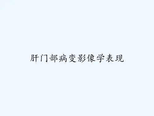 肝门部病变影像学表现ppt