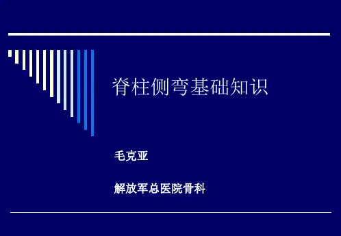 脊柱侧弯基本知识