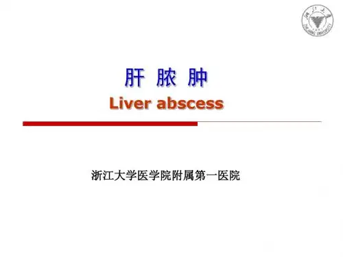 肝脓肿 医学教学课件