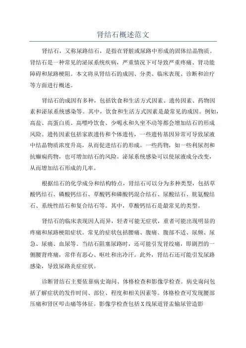 肾结石概述范文