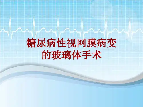 手术讲解模板：糖尿病性视网膜病变的玻璃体手术