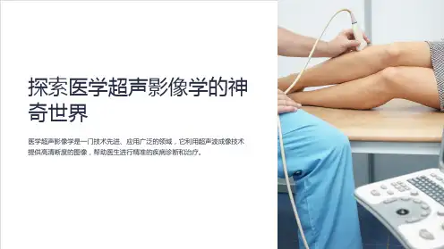 《医学超声影像学》总论ppt课件