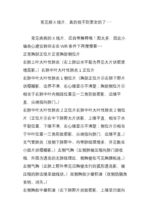 常见病X线片,真的找不到更全的了……