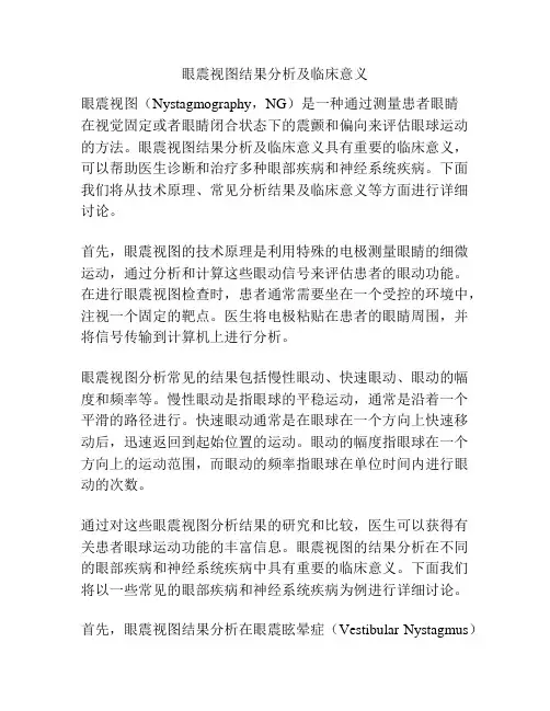 眼震视图结果分析及临床意义