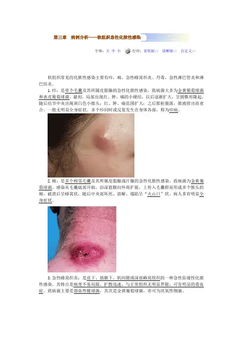 病例分析——软组织急性化脓性感染