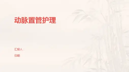动脉置管护理