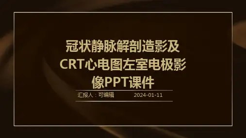 冠状静脉解剖造影及CRT心电图左室电极影像ppt课件