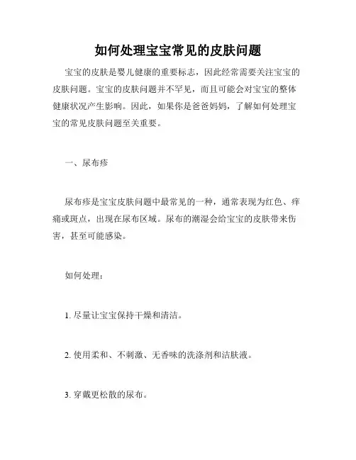 如何处理宝宝常见的皮肤问题