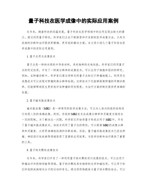 量子科技在医学成像中的实际应用案例
