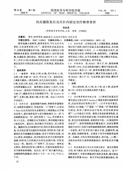 经皮撬拨复位克氏针内固定治疗跟骨骨折