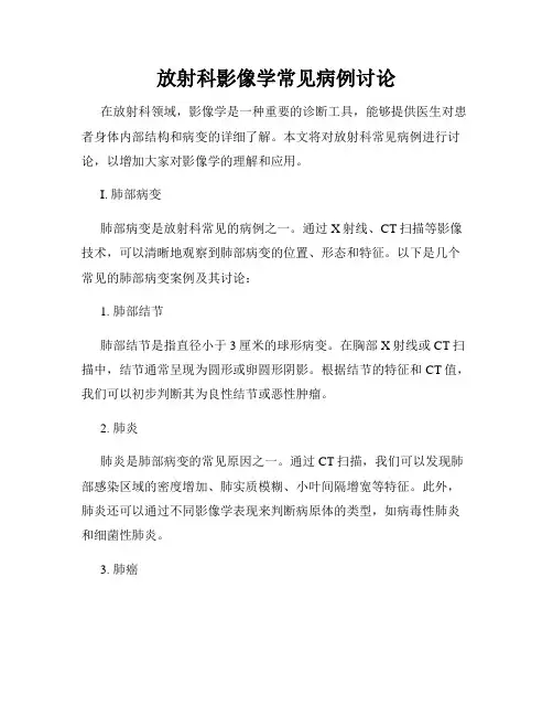 放射科影像学常见病例讨论