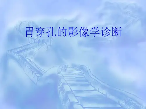 胃穿孔的影像学诊断